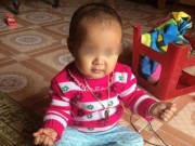 Tin tức - Bé gái 14 tháng tuổi tử vong sau 36 tiếng tiêm vắc xin viêm não