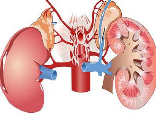 Dấu hiệu cảnh báo ung thư thận không được chủ quan