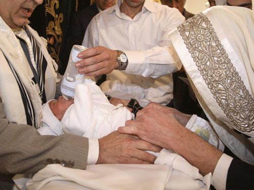 Cắt bao quy đầu bằng miệng, hai trẻ tử vong - 1