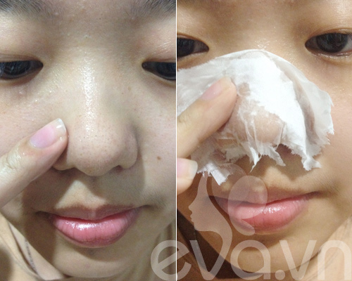Nhật ký Hana: Lột mụn đầu đen ở mũi - 4