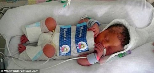 Bé gái thoát chết thần kỳ nhờ ướp lạnh 3 ngày - 1