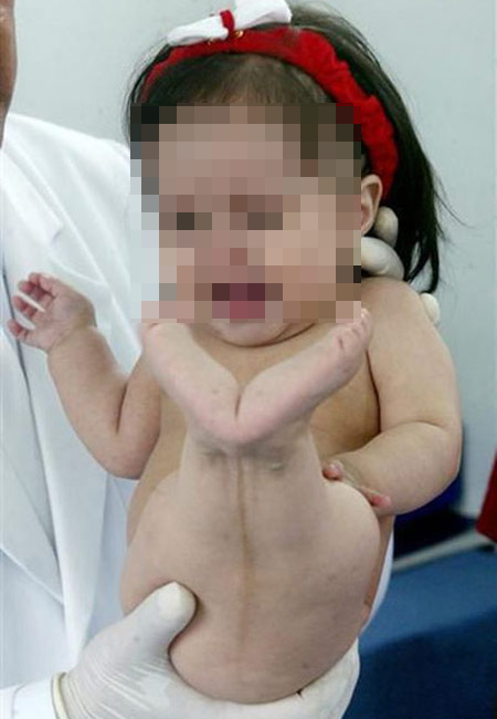 Ngậm ngùi những ca mang thai “lạ” - 1