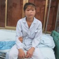 Tin tức - Bé gái bị biến dạng mặt vì có khối u