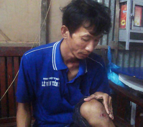 Người đàn ông mắc bệnh lạ #039;cứ đi là ngã#039; - 1