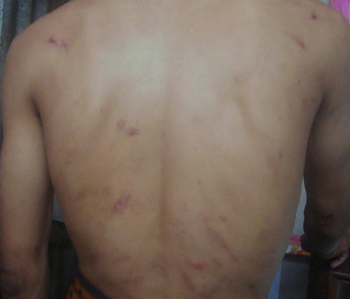 Người đàn ông mắc bệnh lạ #039;cứ đi là ngã#039; - 2