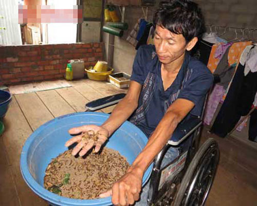 Người đàn ông mắc bệnh lạ #039;cứ đi là ngã#039; - 4