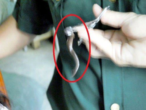 Hai con vắt dài 7cm ngọ nguậy trong mũi - 1