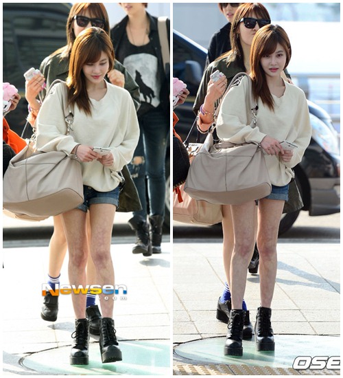 Sốc với chân quot;que củiquot; của sao Hàn - 8