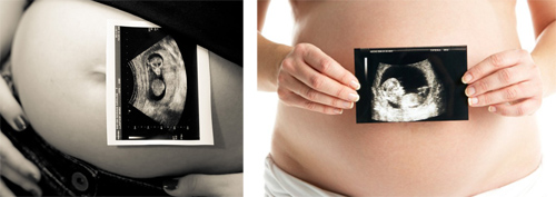 Mẹo chụp ảnh bụng bầu đầy ấn tượng - 5