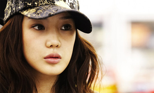 Sao và biến chứng lạm dụng botox - 1