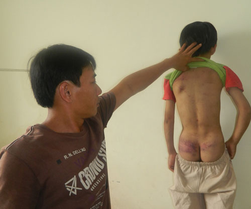 Hận vợ cũ, cha trút đòn thù vào con - 1