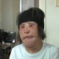 Làm đẹp - Xót xa thảm họa thẩm mỹ Hàn