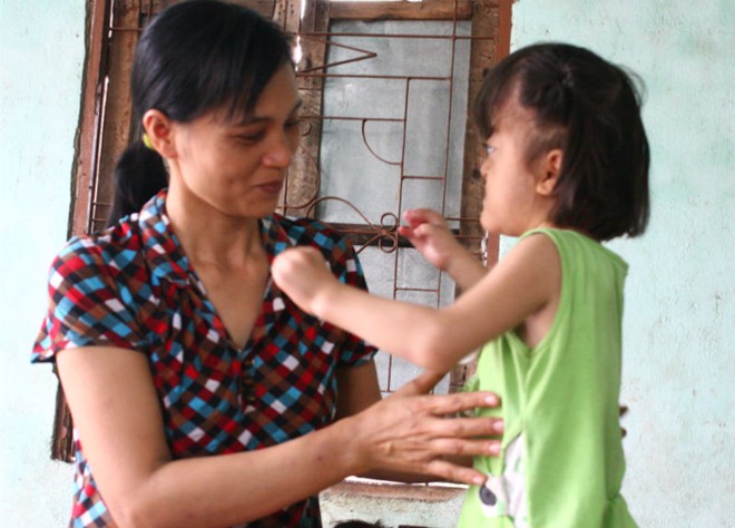 Bé gái 4 tuổi mang khuôn mặt bà lão - 3