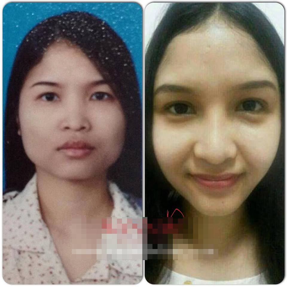 Lạ: Chồng ngoại tình với vợ sau thẩm mỹ - 2
