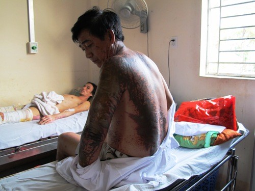 Đi tập thể dục bị tạt axit - 1