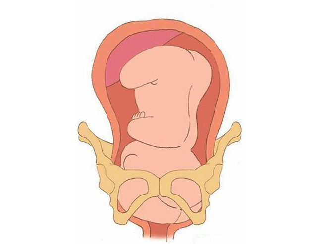Em bé nằm trong bụng mẹ thường ở tư thế úp mặt vào lòng mẹ, đầu quay xuống dưới, tay áp trước ngực.
