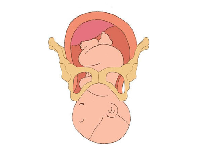 Sau đó, với sự hỗ trợ của các y bác sĩ, cơ thể bé sẽ xoay một góc khoảng 90 độ để dễ dàng cho vai và cơ thể ra khỏi bụng mẹ.
