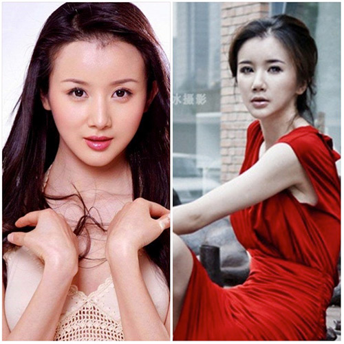 6 sao xinh đẹp bỗng #039;méo mó#039; vì thẩm mỹ - 5