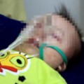 Tin tức - Bộ Y tế thừa nhận đang có dịch sởi