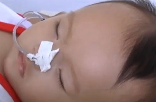 TP.HCM: Sởi chưa tan nhiều bệnh khác đã lan tràn - 2