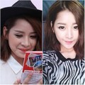 Làm đẹp - Chi Pu bị già đi vì cắt mí?
