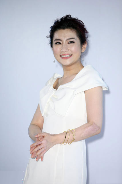 Selina tự tin khoe tay đầy sẹo bỏng - 2