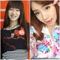 Làm đẹp - Sự thay đổi của cô gái đi cắt mí