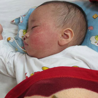 Hiểu đúng về bệnh sởi
