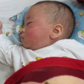 Sức khỏe - Hiểu đúng về bệnh sởi
