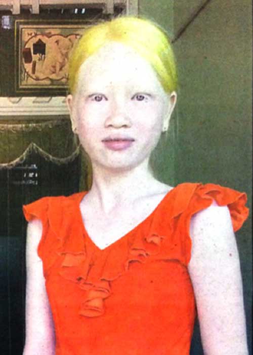 Nỗi đau của #039;cô bé người tuyết#039; giữa đất Việt - 1