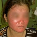 Làm đẹp - Choáng: da siêu trắng sau 2 ngày nhờ mủ trôm?