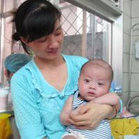 Điều kỳ diệu còn lại trong cặp song sinh mắc sởi