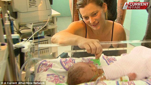 Bé gái có 2 khuôn mặt, 2 bộ não chào đời ở Úc - 3