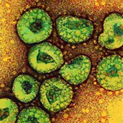 Những đại dịch nguy hiểm nhất thế kỷ 21 - 2