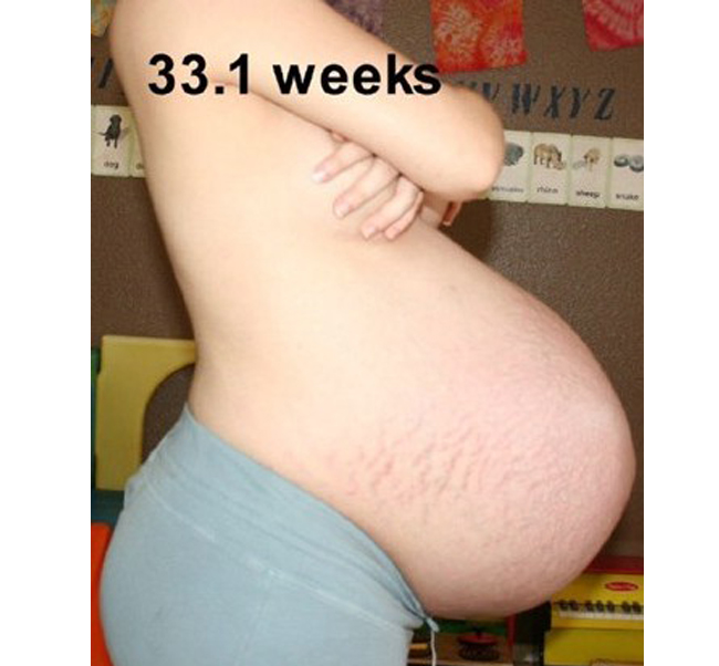 Bước vào tuần thứ 33 thai kỳ, mẹ đã khá mệt mỏi bởi bụng bầu quá lớn.
