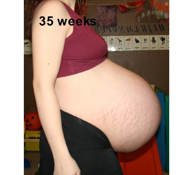 Những tuần cuối thai kỳ, mẹ dành nhiều thời gian để nghỉ ngơi hơn bởi bụng bầu to gây khó khăn cho cô trong việc đi lại.

Vì mang thai 3 nên người mẹ này đã được các bác sĩ chỉ định đẻ mổ ở tuần 37 thai kỳ.
