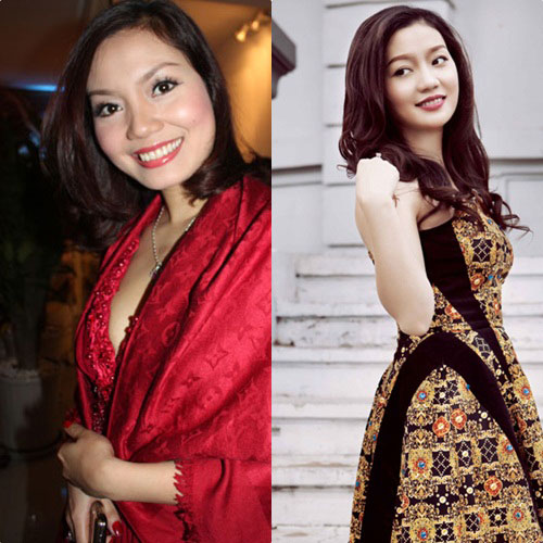 Ca sĩ Ngọc Anh sau khi bơm cằm... - 3