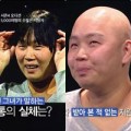 Làm đẹp - Xót xa bà mẹ rụng sạch tóc sau sinh
