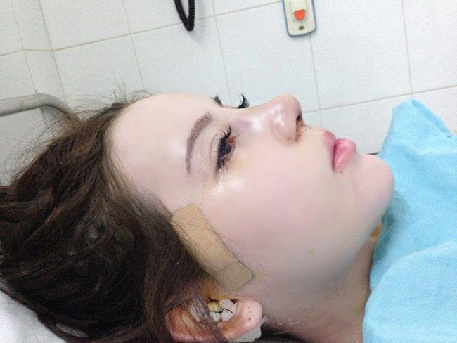 Cô gái đăng tải những bức hình vô cùng đau đớn trên giường phẫu thuật.
