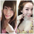 Làm đẹp - Chuyện 'dao kéo' khó tin của 1 hot girl Việt