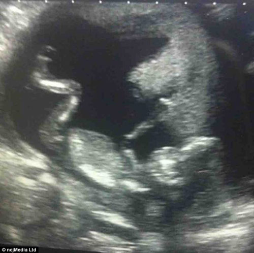 Mang bầu năm 15 tuổi, chồng qua đời - 4