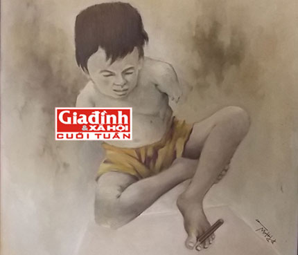 Lý giải cuộc sống trường thọ của người có trái tim bên phải - 1