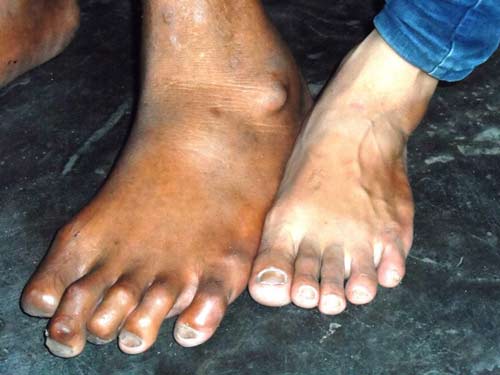 #039;Người khổng lồ#039; cao 2 m ở Quảng Bình - 2