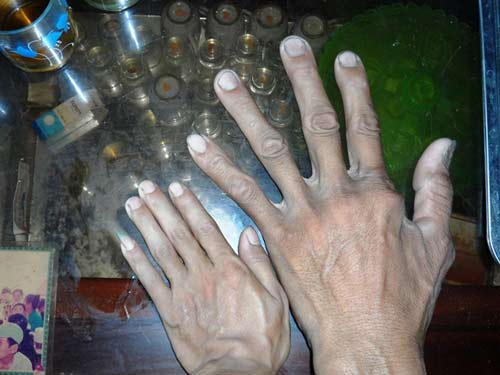 #039;Người khổng lồ#039; cao 2 m ở Quảng Bình - 3