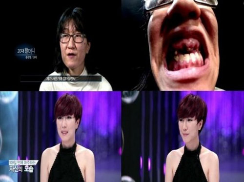 ‘Bà già’ được phẫu thuật thành cô gái trẻ - 1