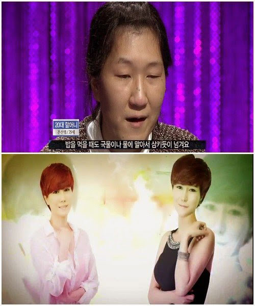 ‘Bà già’ được phẫu thuật thành cô gái trẻ - 4