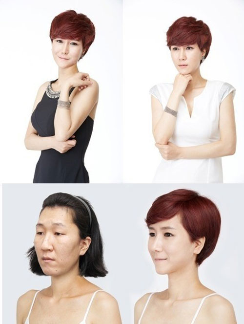 ‘Bà già’ được phẫu thuật thành cô gái trẻ - 5