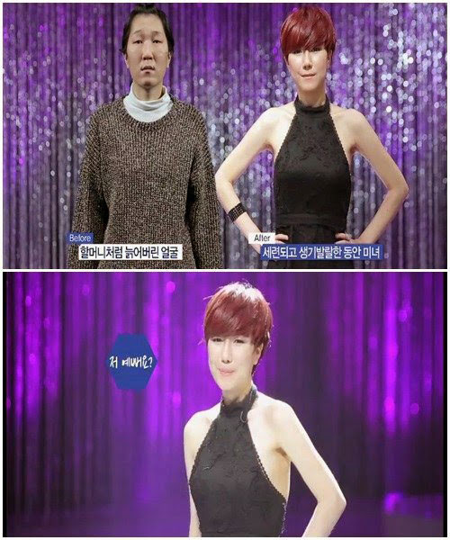 ‘Bà già’ được phẫu thuật thành cô gái trẻ - 6