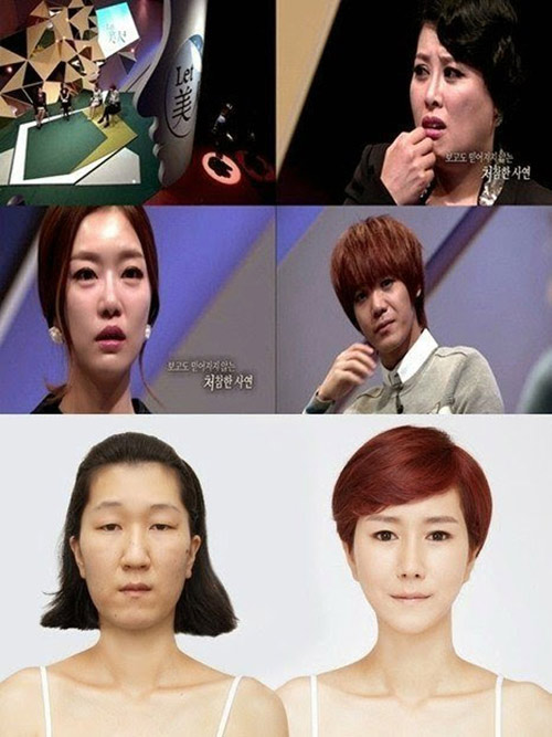 ‘Bà già’ được phẫu thuật thành cô gái trẻ - 3