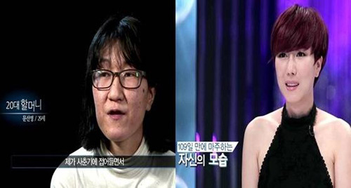 ‘Bà già’ được phẫu thuật thành cô gái trẻ - 2